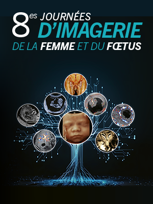 Image cen